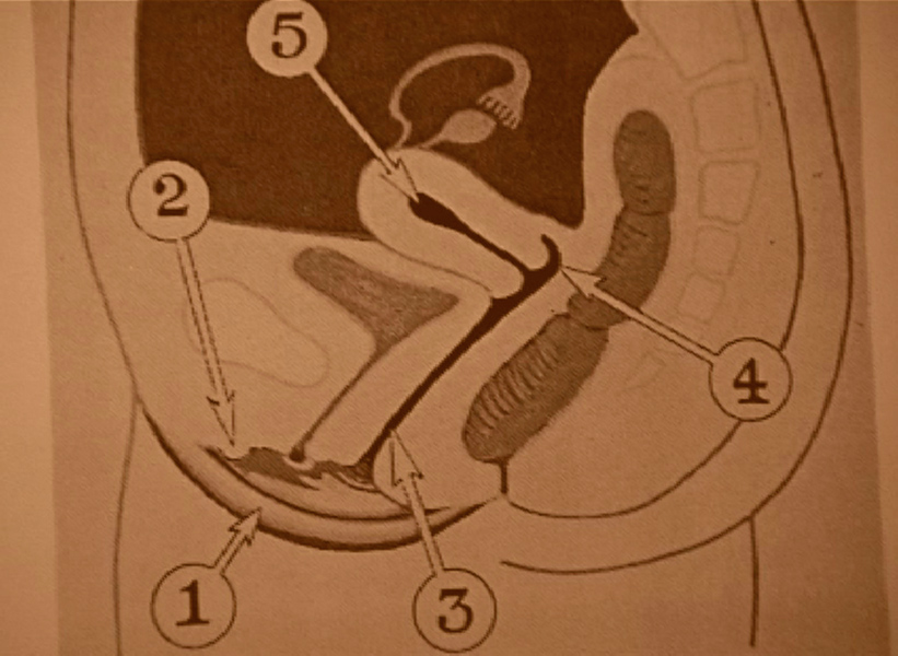 http://www.jorgenmichaelsen.net/files/gimgs/33_15-25c.jpg